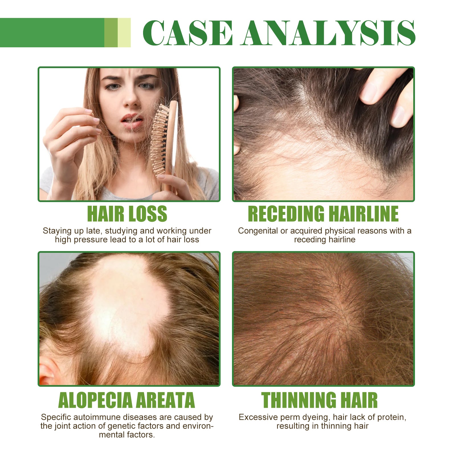 Hair Care Oil, Repair Damage Improve Dry Hair Prevent Hair Loss And Smooth Essential Oil
