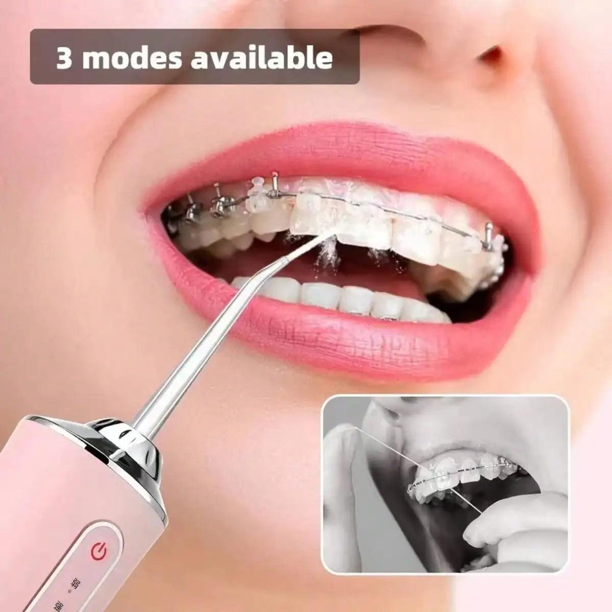 USB Portable Oral Irrigator Water Flosser Dental Water Jet Tools Pick Cleaning Teeth 200ML 4 Nozzles Mouth Oral Cleaning Agents - Jess Deals